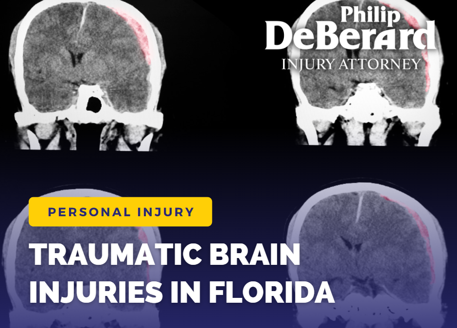 Traumatic Brain Injuries: What Are They and How Can an Attorney Help?